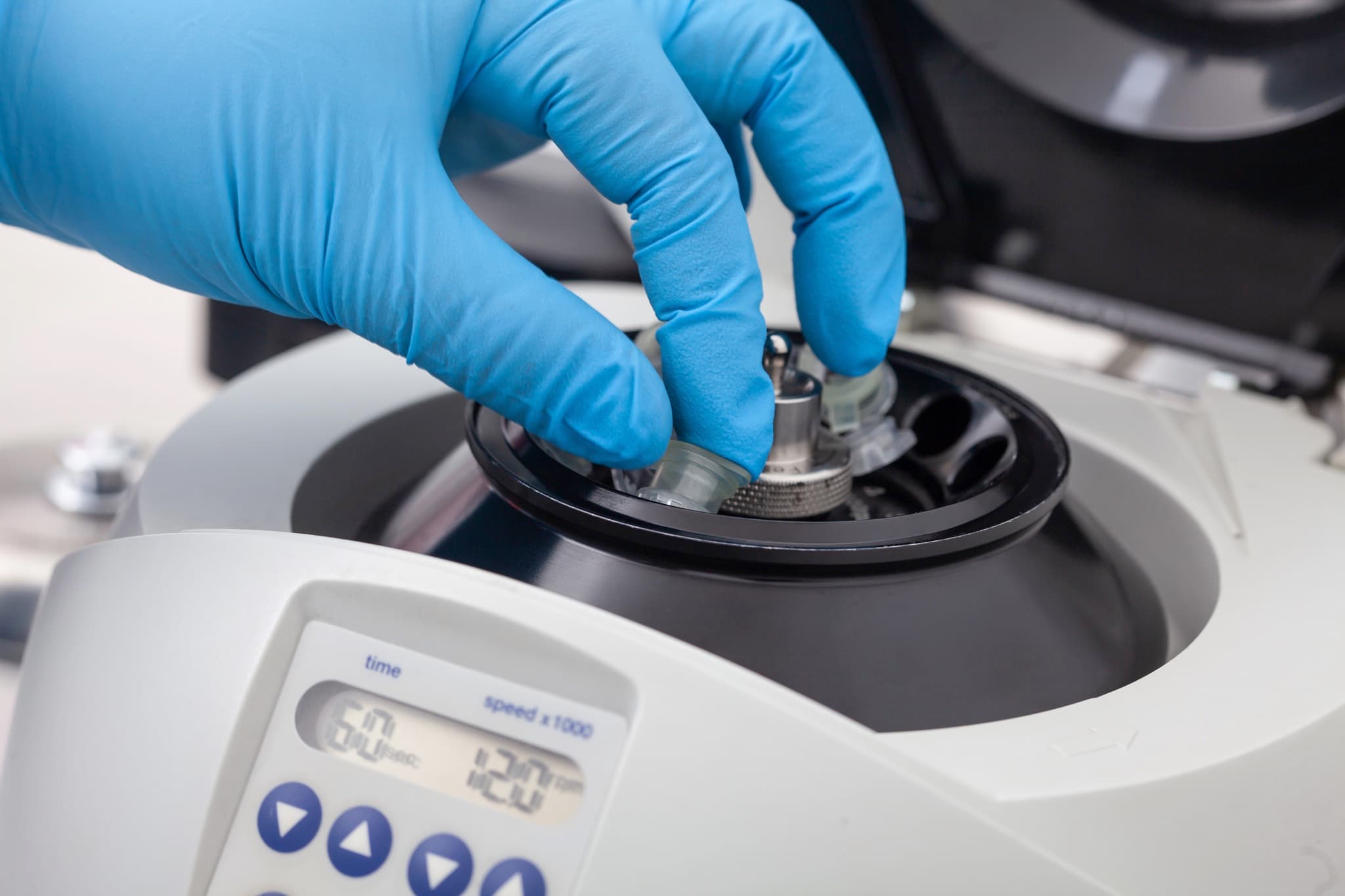 Cell preparation in theatre — loading a centrifuge during a single-stage cartilage procedure